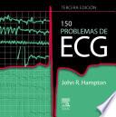 libro 150 Problemas De Ecg