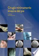 libro Cirugía Mínimamente Invasiva Del Pie