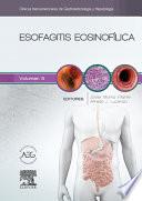 libro Esofagitis Eosinofílica
