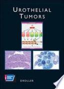 libro Urothelial Tumors